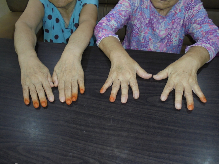 봉숭아 물들이기